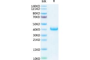Human LILRB4 on Tris-Bis PAGE under reduced conditions. (LILRB4 Protein (AA 22-257) (His-Avi Tag))