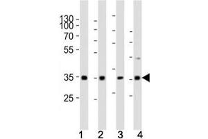 Western blot analysis of lysate from (1) human HeLa cell line, (2) mouse spleen, (3) rat lung, (4) rat stomach tissue using Cyclin D3 antibody at 1:1000. (Cyclin D3 Antikörper  (AA 33-66))