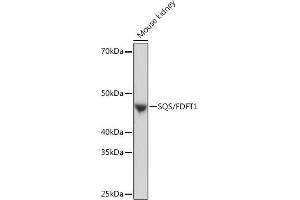 Western blot analysis of extracts of Mouse kidney, using SQS/FDFT1 Rabbit mAb (ABIN7267130) at 1:1000 dilution. (FDFT1 Antikörper)