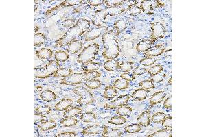 Immunohistochemistry of paraffin-embedded mouse kidney using NUBP1 Rabbit pAb (ABIN7269062) at dilution of 1:100 (40x lens).