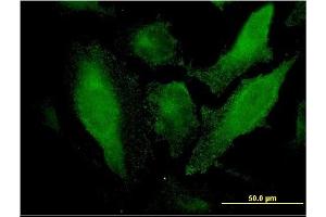 Immunofluorescence of monoclonal antibody to SRCRB4D on HeLa cell. (SRCRB4D Antikörper  (AA 1-190))