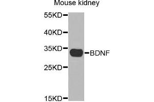 Western Blotting (WB) image for anti-Brain-Derived Neurotrophic Factor (BDNF) (AA 20-247) antibody (ABIN3021893)