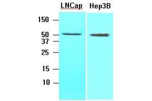 Cell lysates of Lnitrocelluloseap, Hep3B (30 ug) were resolved by SDS-PAGE, transferred to nitrocellulose membrane and probed with anti-human ACOT11 (1:1000). (ACOT11 Antikörper  (AA 19-250))