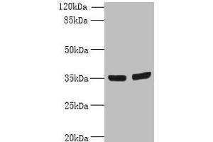 Western blot All lanes: OSR2 antibody at 7 μg/mL Lane 1: Jurkat whole cell lysate Lane 2: Hela whole cell lysate Secondary Goat polyclonal to rabbit IgG at 1/10000 dilution Predicted band size: 36, 31, 49 kDa Observed band size: 36 kDa (OSR2 Antikörper  (AA 101-276))