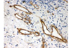 Immunohistochemistry (Paraffin-embedded Sections) (IHC (p)) image for anti-Heparan Sulfate Proteoglycan 2 (HSPG2) (AA 524-701) antibody (ABIN3042466) (HSPG2 Antikörper  (AA 524-701))