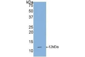 Detection of Recombinant IL1R1, Human using Polyclonal Antibody to Interleukin 1 Receptor Type I (IL1R1) (IL1R1 Antikörper  (AA 21-109))