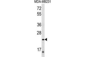 Western Blotting (WB) image for anti-Peroxisomal Biogenesis Factor 11 alpha (PEX11A) antibody (ABIN2997181) (PEX11A Antikörper)