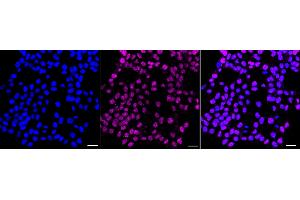 Immunocytochemical staining of HAP-1 cells with ISL1 antibody (ABIN7799129), 1:1,000).