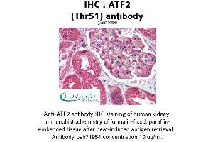Image no. 1 for anti-Activating Transcription Factor 2 (ATF2) antibody (ABIN1732006) (ATF2 Antikörper)