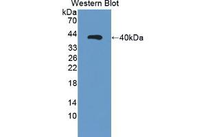 Detection of Recombinant NR3C1, Human using Polyclonal Antibody to Retinaldehyde Binding Protein 1 (RLBP1)
