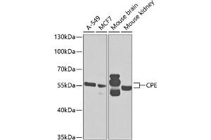 Western blot analysis of extracts of various cell lines, using CPE antibody (ABIN6127655, ABIN6138943, ABIN6138944 and ABIN6221116) at 1:1000 dilution. (CPE Antikörper  (AA 257-476))