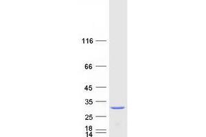 Western Blotting (WB) image for Isoamyl Acetate-Hydrolyzing Esterase 1 Homolog (IAH1) protein (Myc-DYKDDDDK Tag) (ABIN2723196)