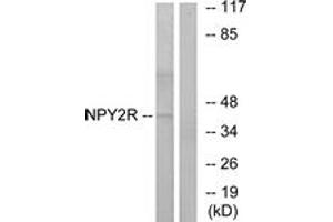 Western blot analysis of extracts from HepG2 cells, using NPY2R Antibody. (NPY2R Antikörper  (AA 1-50))