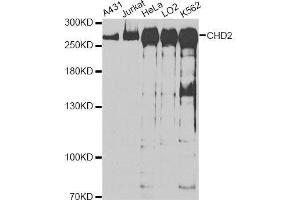 Western blot analysis of extracts of various cell lines, using CHD2 antibody. (CHD2 Antikörper  (C-Term))