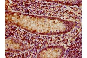 Immunohistochemistry (IHC) image for anti-CD3 epsilon (CD3E) (AA 23-207) antibody (ABIN7171386)