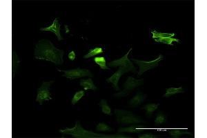 Immunofluorescence of monoclonal antibody to NTRK3 on HeLa cell. (NTRK3 Antikörper  (AA 41-160))