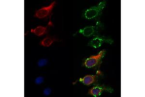ABIN6262617 and ABIN6268893 staining HepG2 by IF/ICC. (Integrin beta 4 Antikörper  (C-Term))