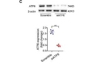 BCAA increase PPAR-α expression in a GCN2/ATF6 pathway-dependent manner. (beta Actin Antikörper)