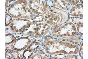 Image no. 1 for anti-Transforming, Acidic Coiled-Coil Containing Protein 3 (TACC3) antibody (ABIN1498098) (TACC3 Antikörper)