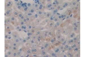 Immunohistochemistry (IHC) image for anti-serpin Peptidase Inhibitor, Clade B (Ovalbumin), Member 1 (SERPINB1) (AA 184-368) antibody (ABIN7435499)