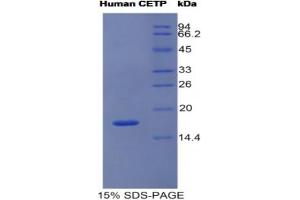 SDS-PAGE analysis of Human CETP Protein.