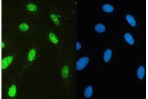 IF analysis of HAUSP/USP7 using anti-HAUSP/USP7 antibody (ABIN5693267).