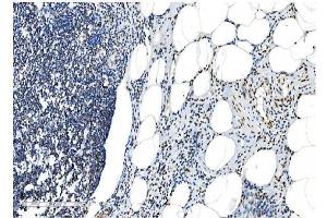 IHC analysis of NRF1 using anti-NRF1 antibody (ABIN7600874). (NRF1 Antikörper  (AA 246-503))