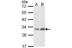 WB Image Sample (30 ug of whole cell lysate) A: Hela B: Hep G2 , 12% SDS PAGE antibody diluted at 1:1000 (PMM2 Antikörper)
