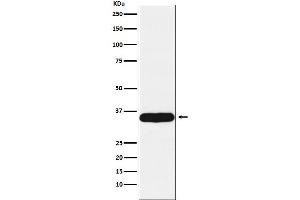 Western blot analysis of Tropomyosin 1 expression in Human heart lysate.