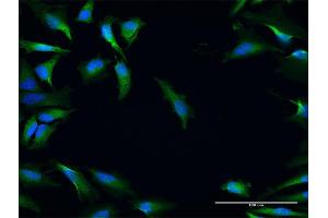Immunofluorescence of purified MaxPab antibody to NRBF2 on HeLa cell. (NRBF2 Antikörper  (AA 1-287))
