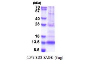 SDS-PAGE (SDS) image for Platelet Factor 4 Variant 1 (PF4V1) (AA 31-104) protein (His tag) (ABIN5853671) (PF4V1 Protein (AA 31-104) (His tag))