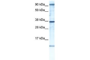 AKAP7 antibody used at 1 ug/ml to detect target protein. (AKAP7 Antikörper)