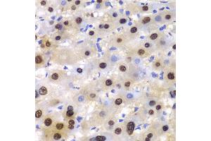 Immunohistochemistry of paraffin-embedded human liver injury using ETS1 antibody (ABIN5970774) at dilution of 1/100 (40x lens).