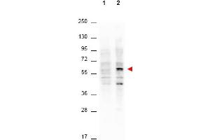 Western Blotting (WB) image for anti-V-Akt Murine Thymoma Viral Oncogene Homolog 1 (AKT1) (Thr308) antibody (ABIN400786) (AKT1 Antikörper  (Thr308))