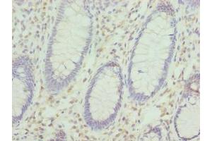 Immunohistochemistry (IHC) image for anti-KH Domain Containing, RNA Binding, Signal Transduction Associated 2 (KHDRBS2) (AA 1-349) antibody (ABIN7157478)