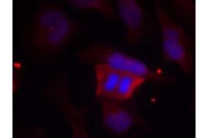 Image no. 1 for anti-Protein Phosphatase 1, Regulatory (Inhibitor) Subunit 1B (PPP1R1B) (pThr75) antibody (ABIN401600) (DARPP32 Antikörper  (pThr75))