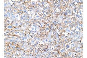 Immunohistochemistry (IHC) image for anti-CD44 (CD44) (AA 692-742) antibody (ABIN7453578) (CD44 Antikörper  (AA 692-742))