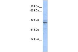 WB Suggested Anti-ZNF625 Antibody Titration:  0. (ZNF625 Antikörper  (N-Term))