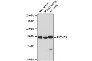 Western blot analysis of extracts of various cell lines using SLC34A3 Polyclonal Antibody at dilution of 1:1000. (SLC34A3 Antikörper)
