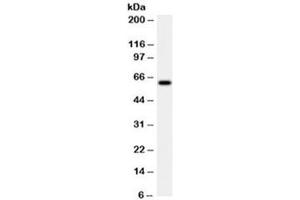 Western blot testing of HeLa cell lysate with HSP60 antibody (clone LK2).