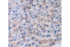 Immunohistochemistry (IHC) image for anti-Secretoglobin, Family 1A, Member 1 (Uteroglobin) (SCGB1A1) (AA 22-96) antibody (ABIN1173807)