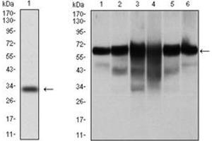 Western Blotting (WB) image for anti-Keratin 5 (KRT5) antibody (ABIN1106933) (Cytokeratin 5 Antikörper)