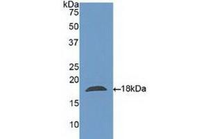 Detection of Recombinant CLC, Human using Polyclonal Antibody to Charcot Leyden Crystal Protein (CLC) (Galectin 10 Antikörper  (AA 2-142))