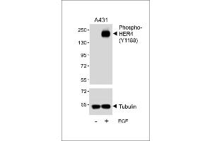 Western blot analysis of lysates from A431 cell line, untreated or treated with EGF, 100 ng/mL, using Phospho-HER4 Antibody (upper) or tubulin (lower). (ERBB4 Antikörper  (pTyr1188))