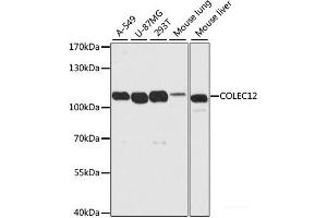 Western blot analysis of extracts of various cell lines using COLEC12 Polyclonal Antibody at dilution of 1:2000. (COLEC12 Antikörper)