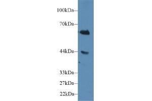 Detection of CD15 in Human Jurkat cell lysate using Polyclonal Antibody to Cluster Of Differentiation 15 (CD15) (CD15 Antikörper  (AA 144-389))