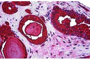 Anti-KLK3 / PSA antibody IHC staining of human prostate.
