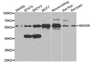 Western blot analysis of extracts of various cell lines, using SMAD5 antibody. (SMAD5 Antikörper  (AA 186-465))