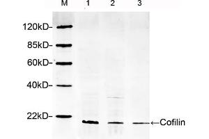 Lane 1: Hela lysateLane 2: HEK293 lysateLane 3: NIH/3T3 lysateWestern blot analysis cell lysates using 1 µg/mL Rabbit Anti-Cofilin Polyclonal Antibody (ABIN398791) The signal was developed with IRDyeTM 800 Conjugated Goat Anti-Rabbit IgG. (Cofilin Antikörper  (AA 100-150))