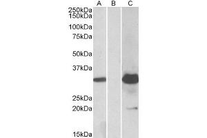 HEK293 lysate (10ug protein in RIPA buffer) overexpressing Human KCTD11 with DYKDDDDK tag probed with ABIN2563535 (1. (KCTD11 Antikörper  (Internal Region))